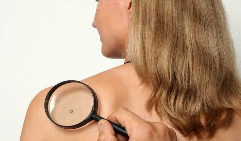 Take advantage of skin cancer prevention