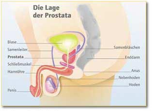 Diagnose Prostatakarzinom... Und trotzdem ein erfülltes Leben.