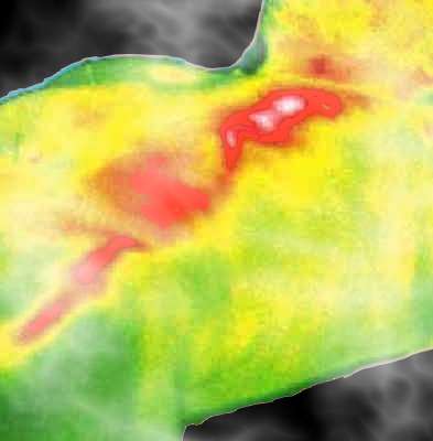 Regulationsthermographie