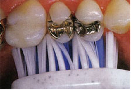 Mund- und Zahnhygiene: Der Gesundheit auf den Zahn gefühlt