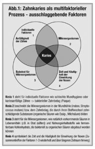 Zucker und Karies – Kariesvorbeugung wirkt