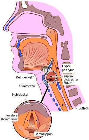 Kehlkopfkrebs (Larynxkarzinom)