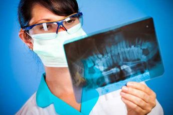 Knochenentzündung bei Zahnimplantaten (Periimplantitis)