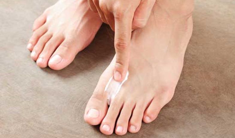 Alternative Heilmethoden gegen Fußpilz