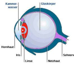 Glaskörpertrübung