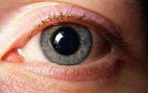 Erkrankungen der Pupille