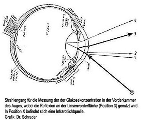 Blutzucker durch Blick ins Auge messen