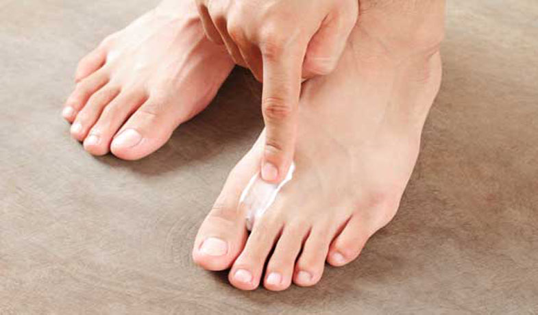 Prevent skin and athlete’s foot |  Gesundheit-Aktuell.de